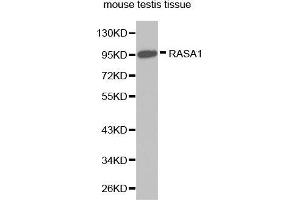Western Blotting (WB) image for anti-RAS P21 Protein Activator (GTPase Activating Protein) 1 (RASA1) (AA 140-220) antibody (ABIN3022297) (RASA1 Antikörper  (AA 140-220))