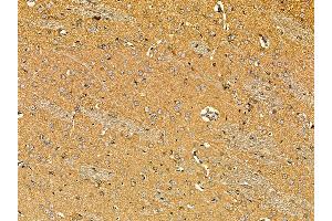 ABIN7095633 and ABIN7099695 at 1/100 staining rat brain tissue by IHC-P.
