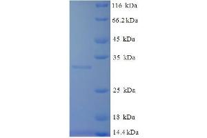 Tryptase beta 2 (Gene/pseudogene) (TPSB2) (AA 30-274) protein (His tag) expressed in E. (TPSB2 Protein (AA 30-274) (His tag))