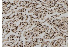 ABIN6279212 at 1/100 staining Human lung tissue by IHC-P. (PDE1A Antikörper  (Internal Region))