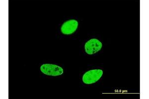 Immunofluorescence of monoclonal antibody to FOXA2 on HeLa cell. (FOXA2 Antikörper  (AA 363-457))