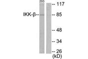 Western Blotting (WB) image for anti-Inhibitor of kappa Light Polypeptide Gene Enhancer in B-Cells, Kinase beta (IKBKB) (AA 161-210) antibody (ABIN2888640) (IKBKB Antikörper  (AA 161-210))