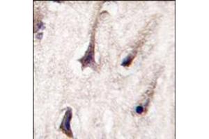 Formalin-fixed and paraffin-embedded human brain tissue reacted with PKC beta2 antibody (C-term), which was peroxidase-conjugated to the secondary antibody, followed by DAB staining. (PKC beta Antikörper  (C-Term))
