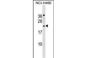 GLIPR1L1 Antibody (C-term) (ABIN1536826 and ABIN2849524) western blot analysis in NCI- cell line lysates (35 μg/lane). (GLIPR1L1 Antikörper  (C-Term))