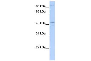 WB Suggested Anti-FGD1 Antibody Titration:  0. (FGD1 Antikörper  (N-Term))