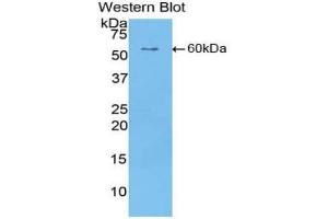 Western blot analysis of the recombinant protein. (CILP Antikörper  (AA 603-846))