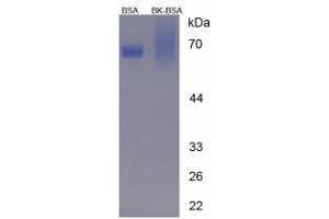 Image no. 2 for Kininogen 1 (KNG1) peptide (BSA) (ABIN5665946)