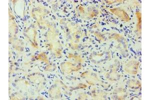 Immunohistochemistry of paraffin-embedded human kidney tissue using ABIN7146856 at dilution of 1:100