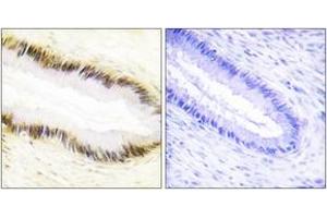 Immunohistochemistry (IHC) image for anti-Nuclear Receptor Subfamily 2, Group F, Member 6 (NR2F6) (AA 11-60) antibody (ABIN1533607)