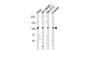 Western blot analysis of lysates from Hela, NCI-H460, mouse NIH/3T3 cell line and human ovary tissue lysate (from left to right), using EPHA4 Antibody (R890) at 1:1000 at each lane. (EPH Receptor A4 Antikörper  (C-Term))