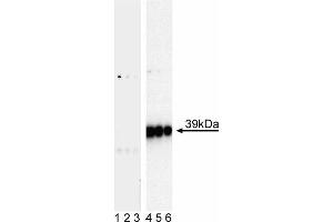 Western blot analysis of c-Jun (pS63) in human vascular endothelium.