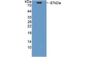 Detection of Recombinant PCSK9, Mouse using Polyclonal Antibody to Proprotein Convertase Subtilisin/Kexin Type 9 (PCSK9) (PCSK9 Antikörper  (AA 156-694))