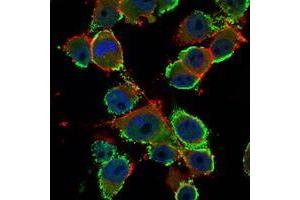 Immunofluorescence analysis of PANC-1 cells using CEA mouse mAb (green). (CEA Antikörper)