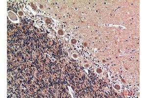 Immunohistochemistry (IHC) analysis of paraffin-embedded Human Brain, antibody was diluted at 1:100. (RSAD2 Antikörper  (Internal Region))