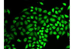 Immunofluorescence analysis of HeLa cell using USP7 antibody. (USP7 Antikörper  (AA 206-1102))