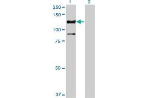 Western Blot analysis of STK31 expression in transfected 293T cell line by STK31 monoclonal antibody (M02), clone 1C10. (STK31 Antikörper  (AA 920-1019))