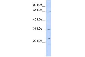 WB Suggested Anti-EME1 Antibody Titration: 0.