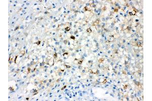 Anti- TLR5 Picoband antibody, IHC(P) IHC(P): Human Appendicitis Tissue