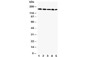 Western blot testing of GLI2 antibody and Lane 1: MCF-7 (GLI2 Antikörper  (C-Term))