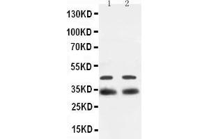 Western Blotting (WB) image for anti-SRY (Sex Determining Region Y)-Box 2 (SOX2) (AA 171-183), (Middle Region) antibody (ABIN3044477) (SOX2 Antikörper  (Middle Region))