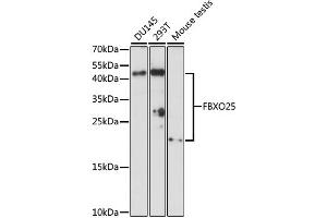 Western blot analysis of extracts of various cell lines, using FBXO25 antibody (ABIN6292075) at 1:1000 dilution.