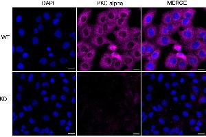 Immunocytochemical staining of HT- cells using PKC alpha antibody (ABIN7799991), 1:1,000), Top panel: wild-type (WT), Bottom panal: PKC alpha shRNA knockdown (KD).