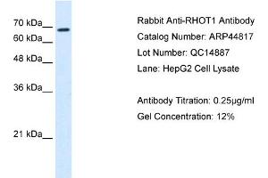 Western Blotting (WB) image for anti-Ras Homolog Gene Family, Member T1 (RHOT1) (N-Term) antibody (ABIN310631) (RHOT1 Antikörper  (N-Term))