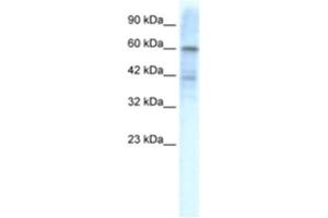 Western Blotting (WB) image for anti-Potassium Voltage-Gated Channel, Shal-Related Subfamily, Member 3 (KCND3) antibody (ABIN2461109)