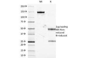 SDS-PAGE Analysis of Purified, BSA-Free TNF-alpha Antibody (clone J2D10).