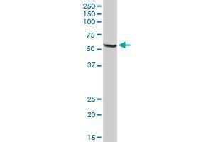 WARS MaxPab rabbit polyclonal antibody. (WARS Antikörper  (AA 1-471))