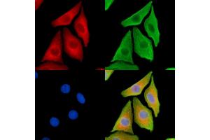 ABIN7095333 and ABIN7099390 staining Hela cells by IF/ICC. (COPA Antikörper)