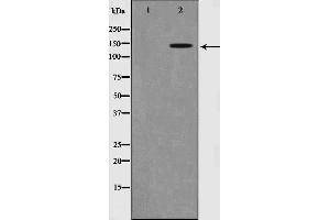 Western Blotting (WB) image for anti-Neurotrophic Tyrosine Kinase, Receptor, Type 2 (NTRK2) (pTyr516) antibody (ABIN6255941)
