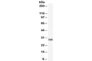 Western blot testing of human kidney lysate with CLIC4 antibody at 0. (CLIC4 Antikörper)