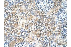 Image no. 1 for anti-Replication Factor C (Activator 1) 5, 36.5kDa (RFC5) (N-Term) antibody (ABIN6738219) (RFC5 Antikörper  (N-Term))