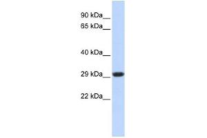 SDHB antibody used at 1 ug/ml to detect target protein. (SDHB Antikörper)