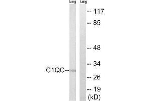 Western Blotting (WB) image for anti-Complement Component 1, Q Subcomponent, C Chain (C1QC) (Internal Region) antibody (ABIN1851148) (C1QC Antikörper  (Internal Region))