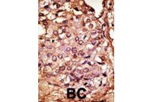 Immunohistochemistry (IHC) image for anti-Chemokine Binding Protein 2 (CCBP2) antibody (ABIN3001323) (CCBP2 Antikörper)