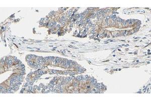 ABIN6275020 at 1/100 staining Human prostate tissue by IHC-P. (CLASP1 Antikörper  (Internal Region))