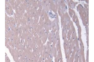 Immunohistochemistry (IHC) image for anti-ATP-Binding Cassette, Sub-Family C (CFTR/MRP), Member 6 (ABCC6) (AA 1260-1502) antibody (ABIN7444988)