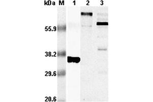 Western blot analysis using anti-RANKL (human), pAb  at 1:5,000 dilution. (RANKL Antikörper)