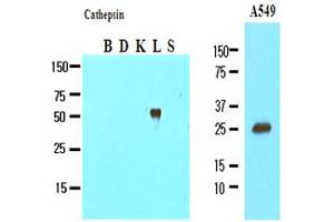 Western Blotting (WB) image for anti-Cathepsin L1 (CTSL1) (AA 114-333) antibody (ABIN317508)