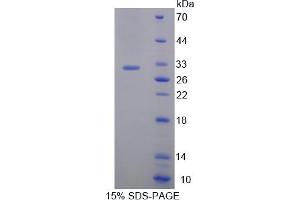 Image no. 1 for BMX Non-Receptor Tyrosine Kinase (BMX) (AA 209-446) protein (His tag) (ABIN6238217) (BMX Protein (AA 209-446) (His tag))