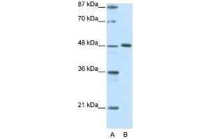 WB Suggested Anti-ZNF259  Antibody Titration: 0. (ZNF259 Antikörper  (C-Term))