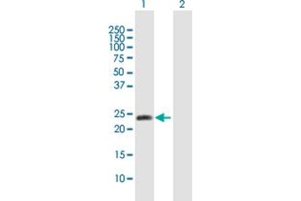 METTL11A Antikörper  (AA 1-223)