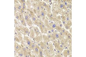 Immunohistochemistry of paraffin-embedded human liver injury using TXNL1 antibody (ABIN5973739) at dilution of 1/100 (40x lens).