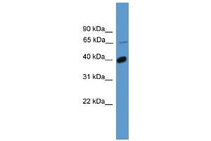 WB Suggested Anti-OR2B2 Antibody Titration: 1.
