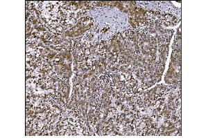 IHC analysis of LRP1B using anti-LRP1B antibody (ABIN7601521). (LRP1B Antikörper  (AA 3704-4547))