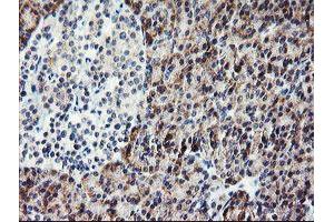 Immunohistochemistry (IHC) image for anti-Platelet/endothelial Cell Adhesion Molecule (PECAM1) antibody (ABIN1497243) (CD31 Antikörper)