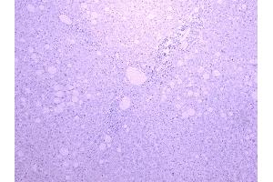 ABIN185606 Negative Control showing staining of paraffin embedded Human Liver, with no primary antibody.