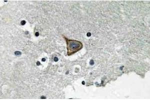 Immunohistochemistry (IHC) analyzes of p-Connexin 43 antibody in paraffin-embedded human brain tissue. (Connexin 43/GJA1 Antikörper  (pSer367))